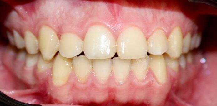 После лечения — Случай 2