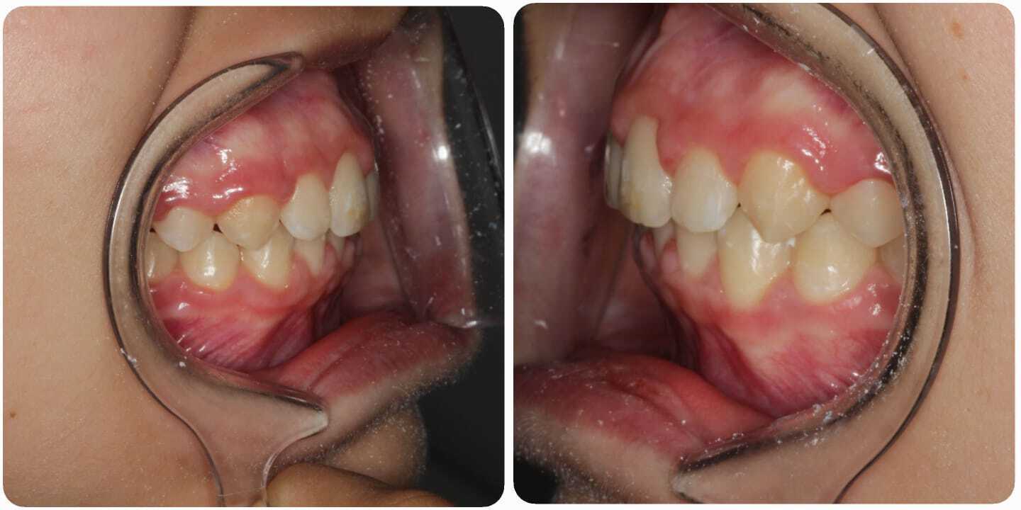 После лечения — Случай 3