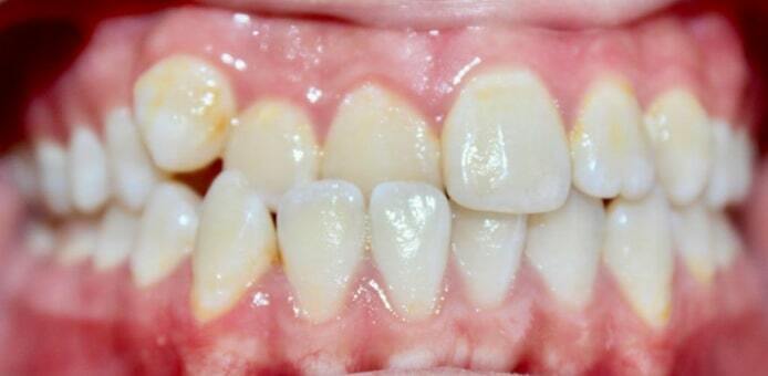 До лечения — Случай 1